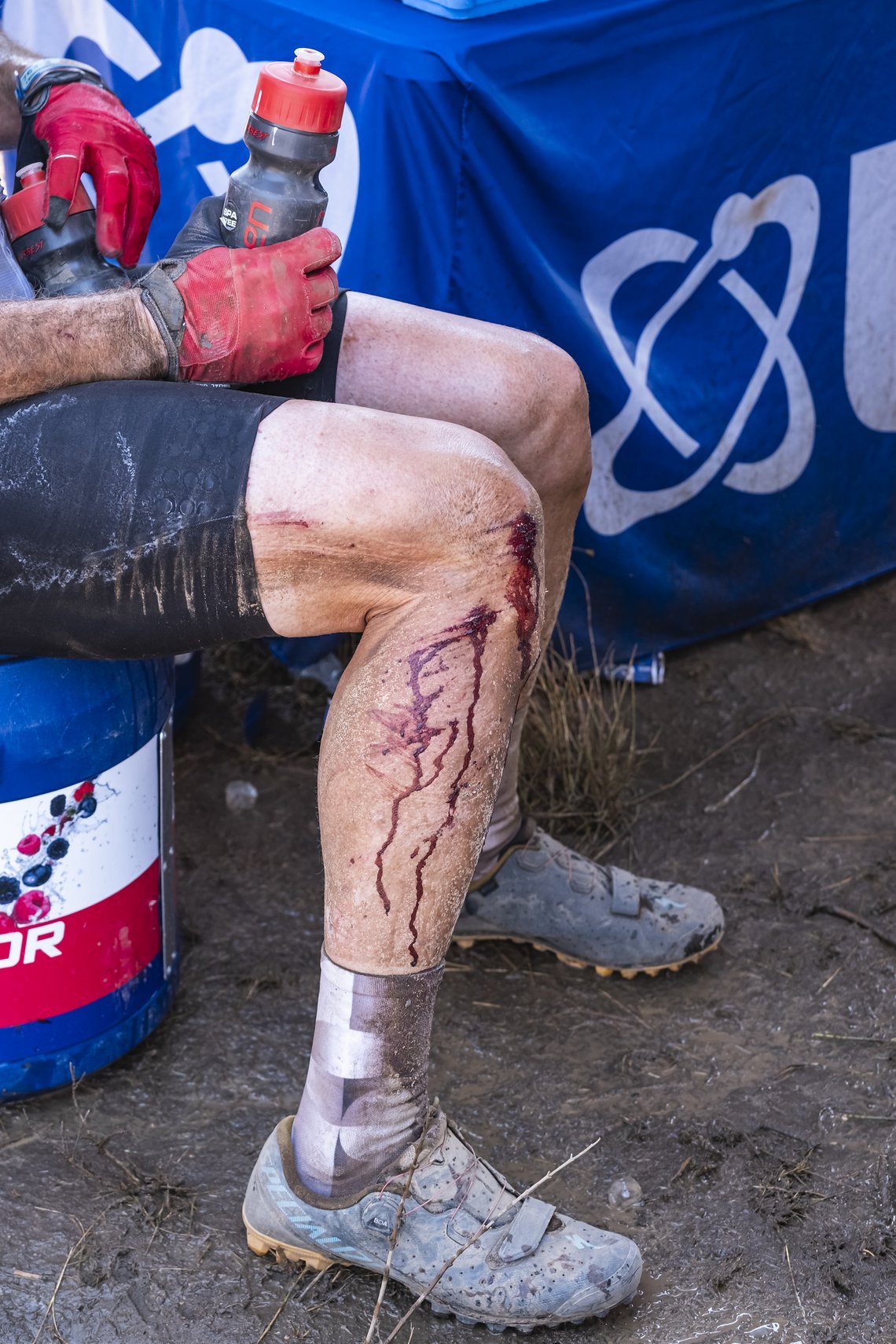 Rider with some battle scars cools down under the USN tent during a extremely hot Stage 3 of the 2025 Absa Cape Epic Mountain Bike stage race held at Fairview, Paarl, Cape Town, South Africa on the 19th March 2025. Photo by Dom Barnardt/Cape Epic
PLE